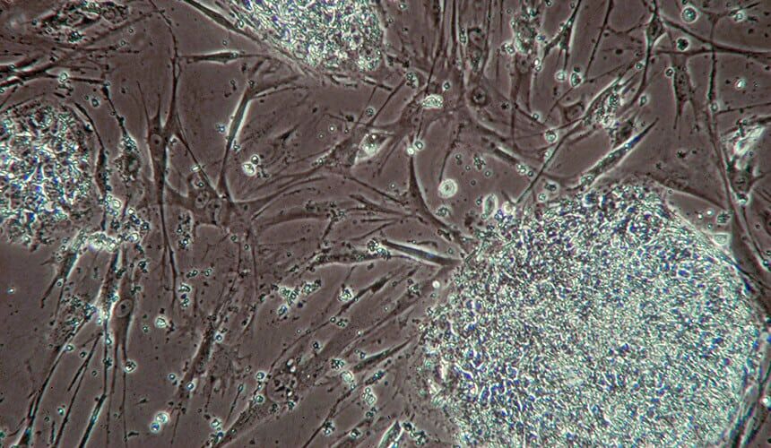 Microscopic view of a colony of original human embryonic stem cell lines.