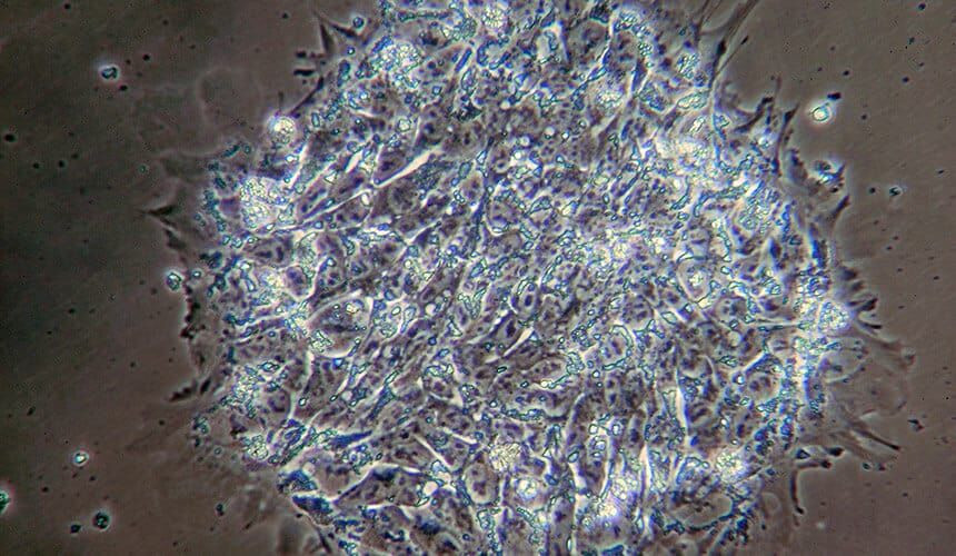 Photograph of stem cells.