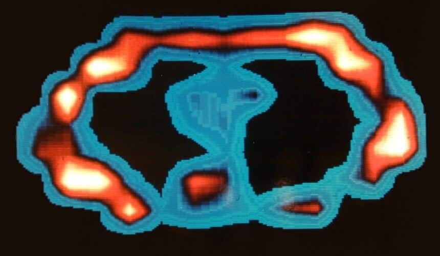 Magnetic resonance imaging (MRI) scan of a live human body